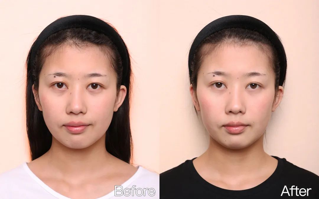 小茂专家团特别版｜雅诗兰黛黑松露眼霜