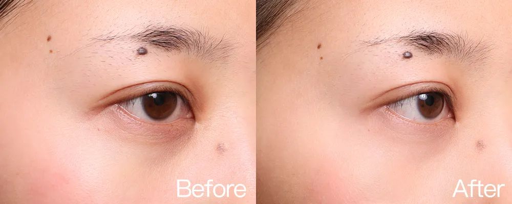 小茂专家团特别版｜雅诗兰黛黑松露眼霜