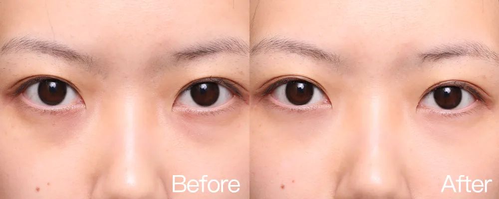 小茂专家团特别版｜雅诗兰黛黑松露眼霜