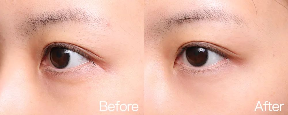 小茂专家团特别版｜雅诗兰黛黑松露眼霜