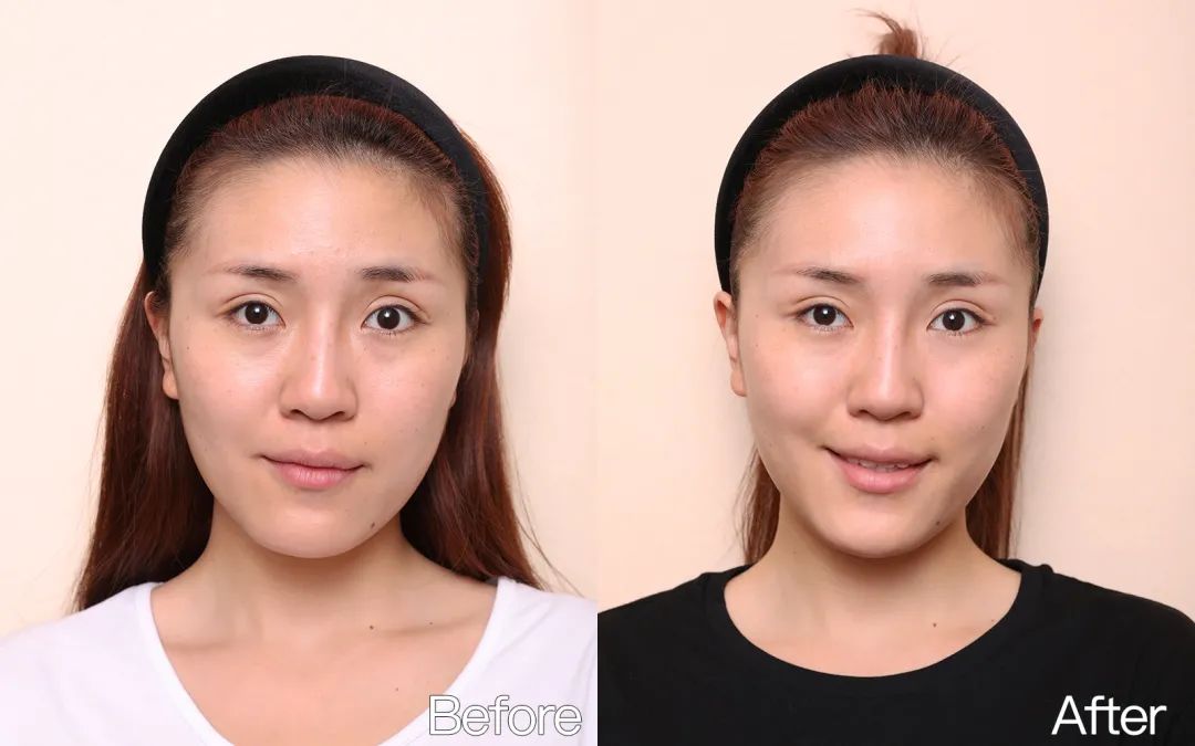 小茂专家团特别版｜雅诗兰黛黑松露眼霜