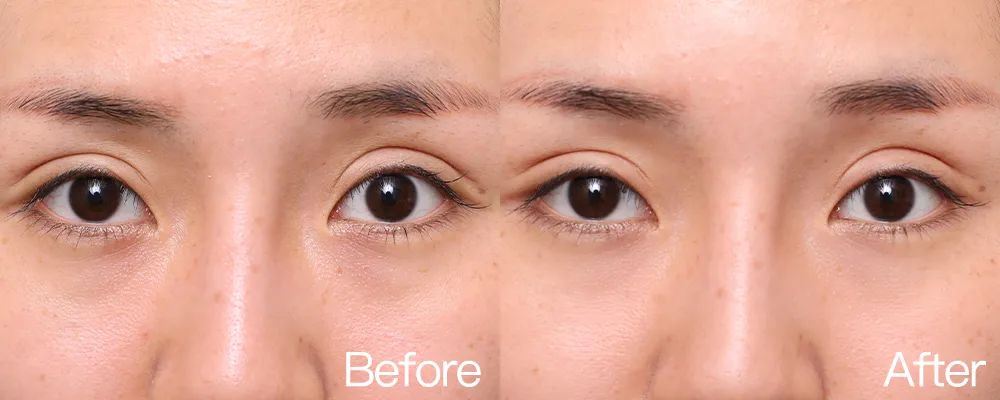 小茂专家团特别版｜雅诗兰黛黑松露眼霜