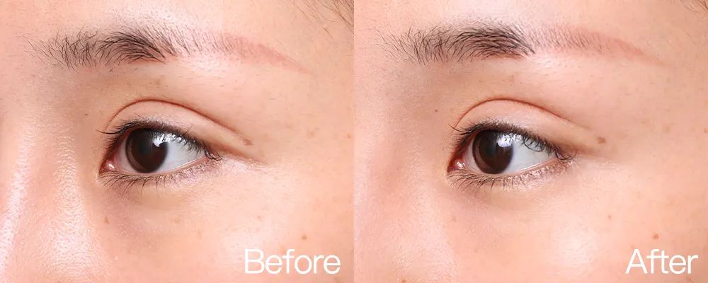 小茂专家团特别版｜雅诗兰黛黑松露眼霜