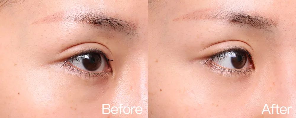 小茂专家团特别版｜雅诗兰黛黑松露眼霜