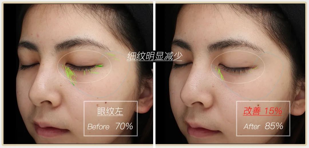 小茂专家团特别版｜雅诗兰黛黑松露眼霜