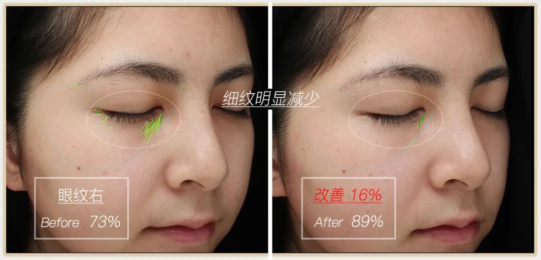 小茂专家团特别版｜雅诗兰黛黑松露眼霜