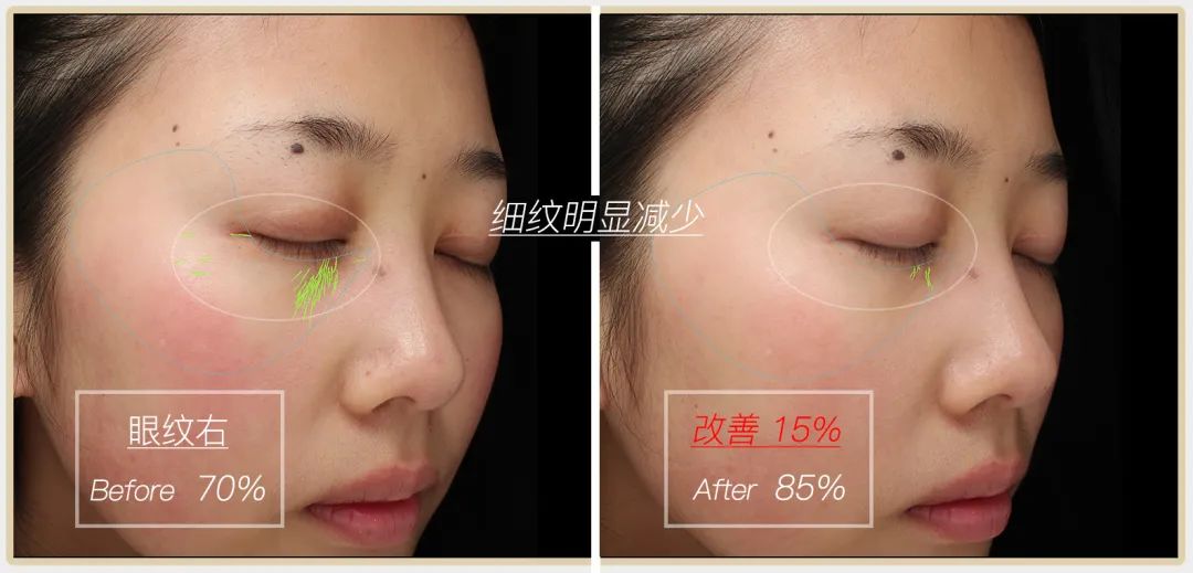 小茂专家团特别版｜雅诗兰黛黑松露眼霜