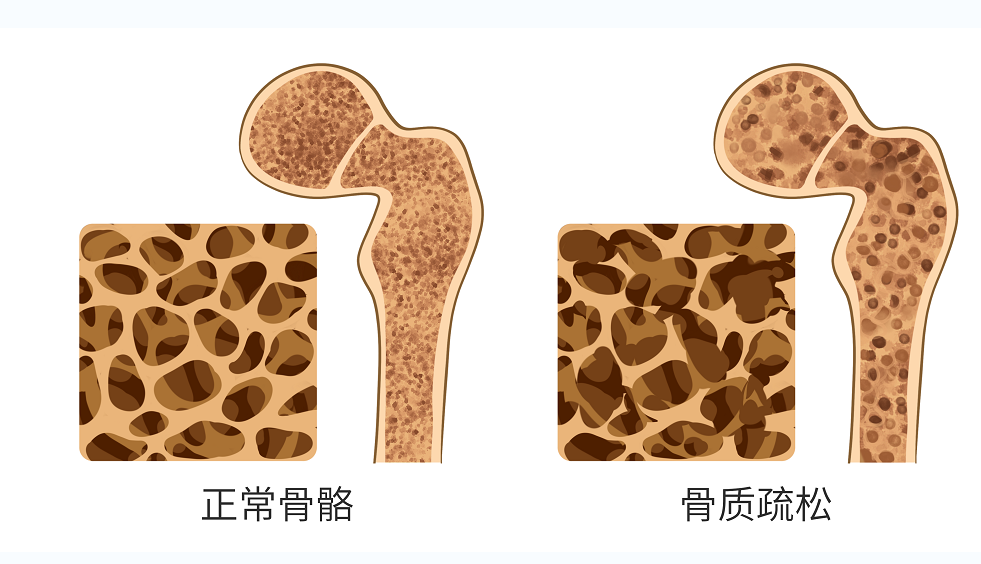 经常腿肿、周身酸痛，女性易中招！原因和改善方法都在这！