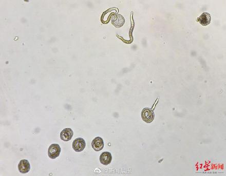 全球首例！8岁男孩全眼白内障或与养宠物有关！专家提醒：养狗家庭要特别注意