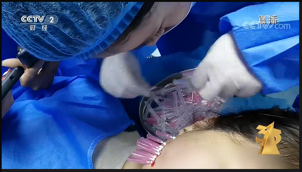 315晚会曝光的医美培训乱象，只是美业负面的冰山一角