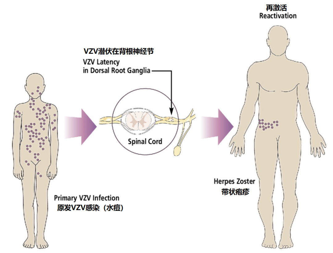 儿童如果出现疼痛性皮疹，不要忘了这个病......