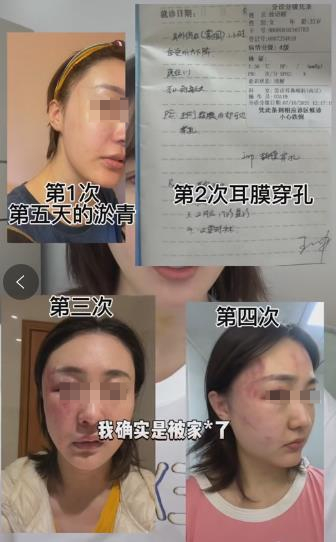 女网红举报丈夫多次家暴并让其留遗言，丈夫回应：借此炒作、博取流量