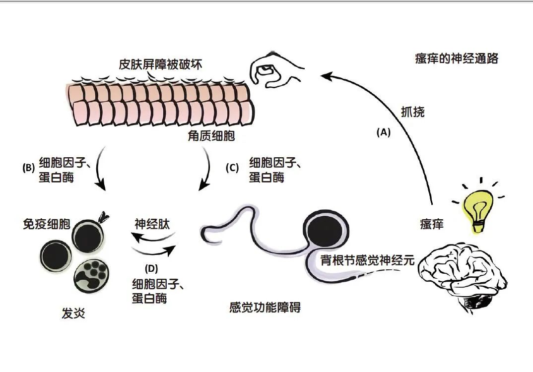 我们都会产生“痒”的感觉，“痒”从何处来呢？