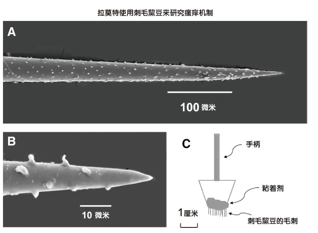 我们都会产生“痒”的感觉，“痒”从何处来呢？