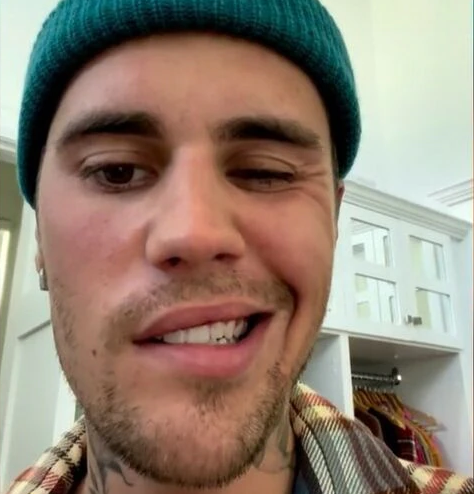 贾斯丁比伯脸瘫？！不能靠脸吃饭，老婆后悔嫁他？