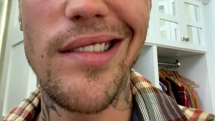 贾斯丁比伯脸瘫？！不能靠脸吃饭，老婆后悔嫁他？