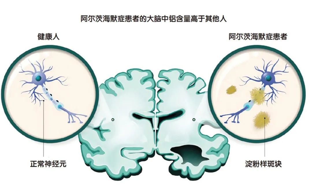 如果我们都是“铝”人……