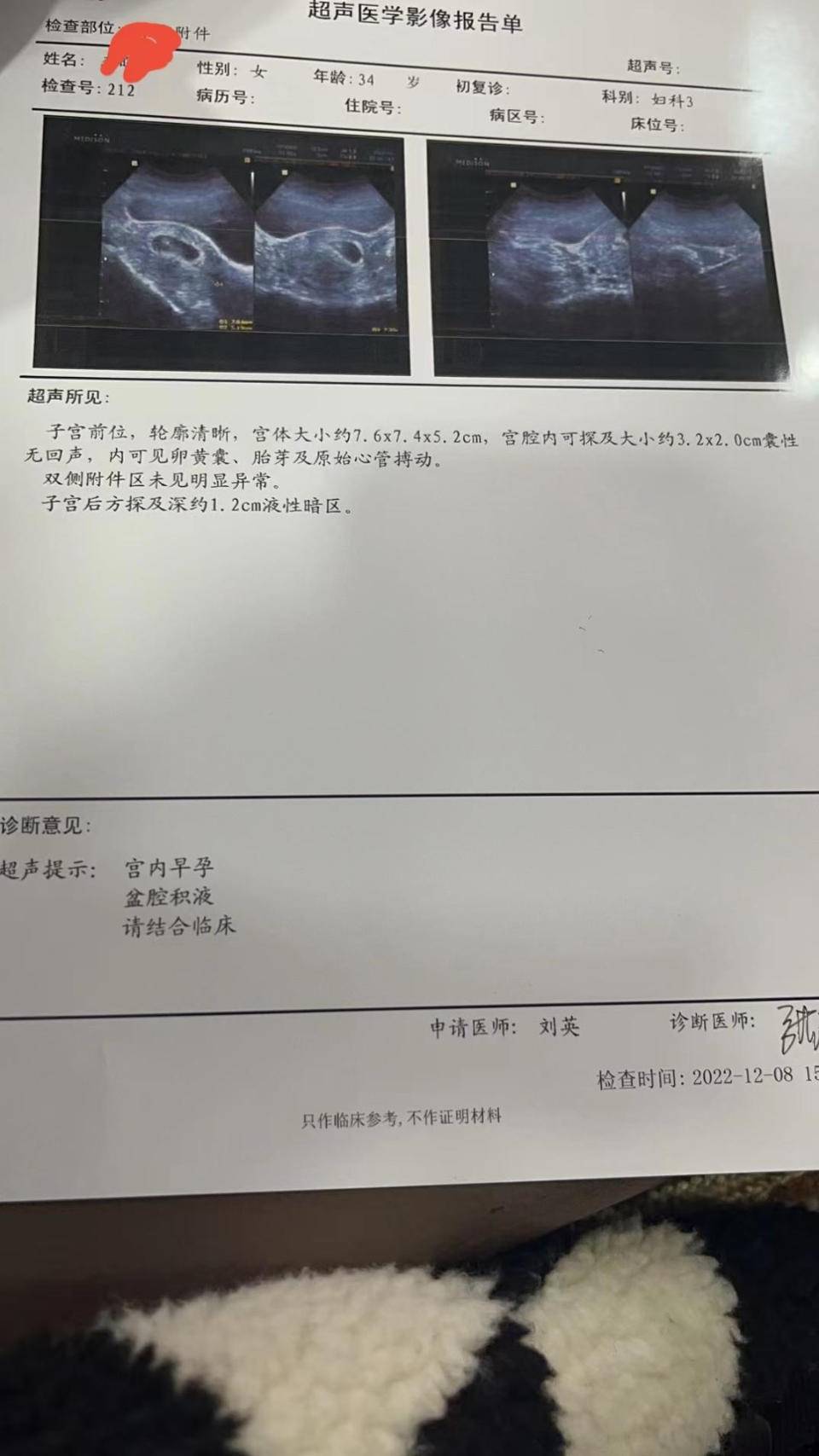 备孕三胎失败三次，生化、宫外孕后的她是怎么如愿要娃的？