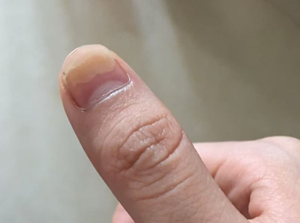 发霉、变灰、分层……如何守护“指尖上的美丽”？