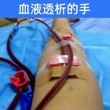 尿毒症面面