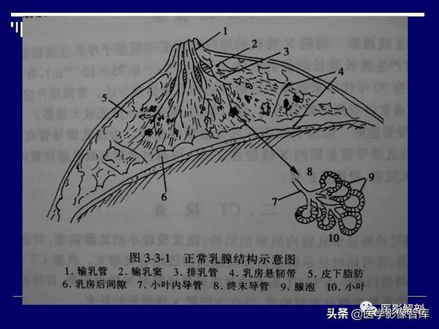 乳房解剖学基础知识，乳腺解剖及乳腺各病变影像诊断与鉴别