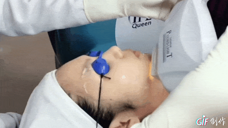 光子嫩肤全身效果对比(光子嫩肤真的能消除毛孔粗大吗)