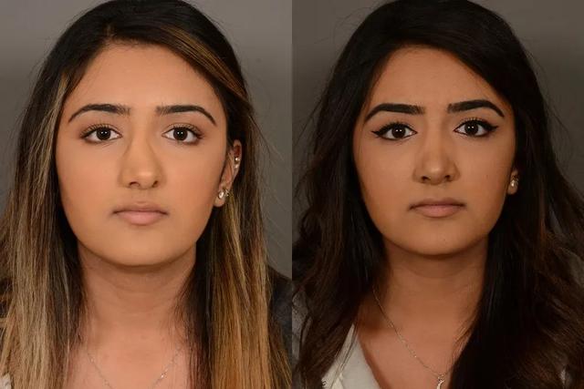 空鼻症患者之痛:这种引发了无数医闹矛盾的争议病是怎么回事?