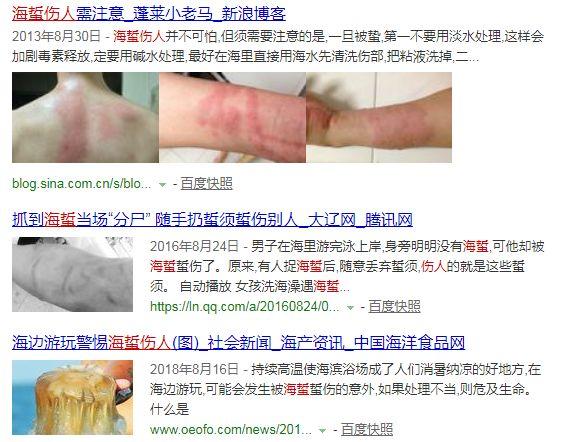 海蜇头怎么处理，海蜇头凉拌太硬了处理方法（这种神秘的海产品随着入伏走来了~）