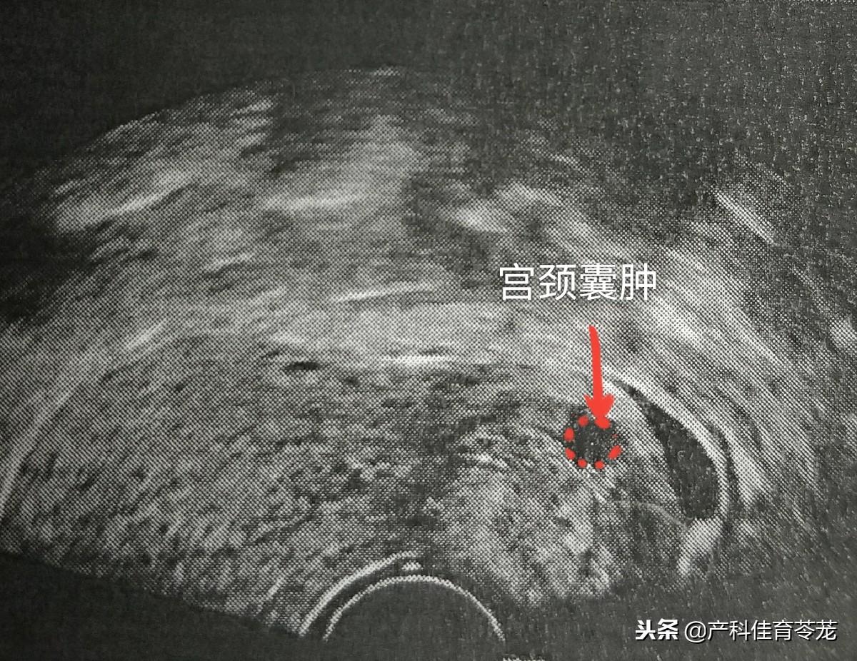 子宫宫颈图片素材-编号24127014-图行天下