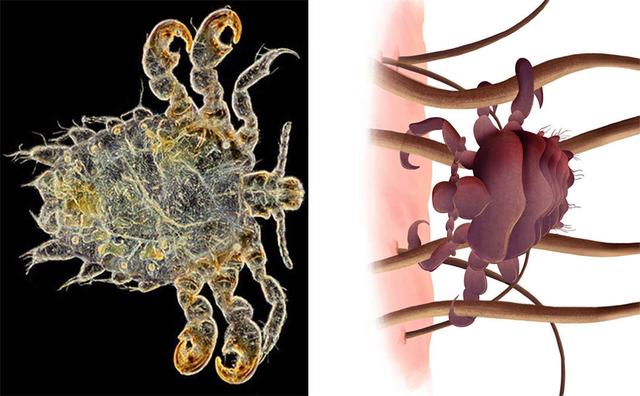 阴虱这种小虫子只寄生在人身上,为什么到了头发就会死?