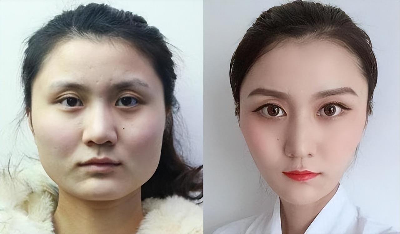 削骨整容手术多少钱(削骨整容风险很大) - 价格百科