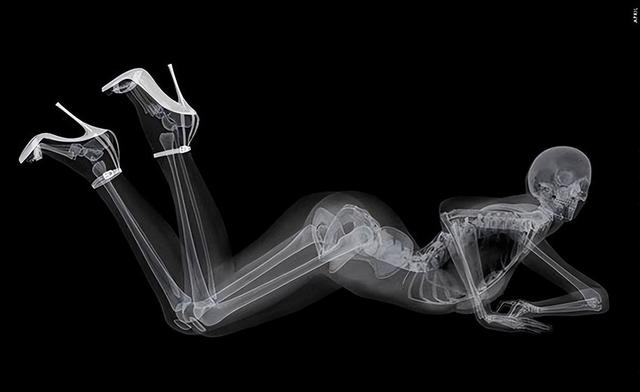什么动作可以判断骨骺线，基于人体骨骼序列的动作识别与预测