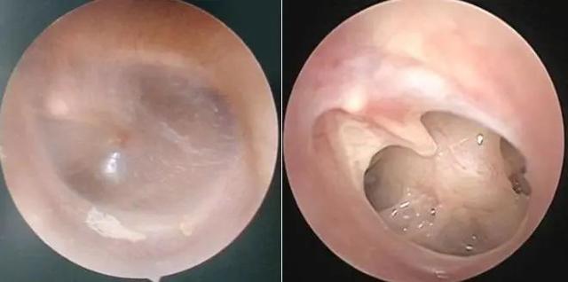 耳部结构图(耳朵构造三维图)