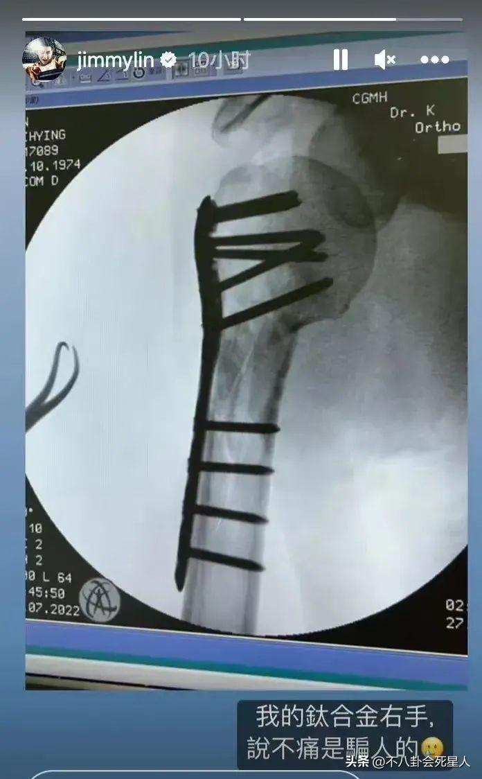 林志颖现状照片（网友：眼袋和法令纹明显）